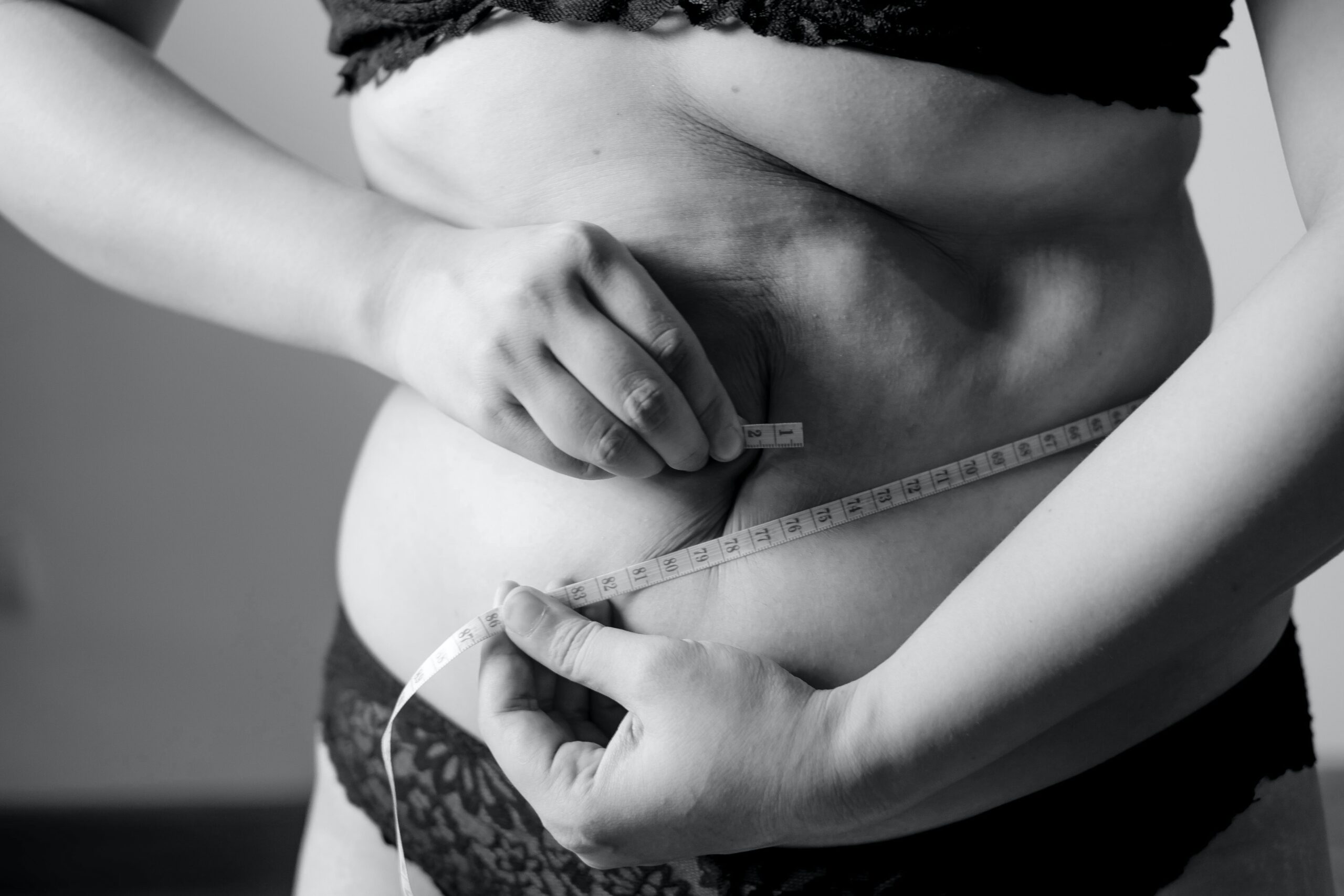 Abdominal fat